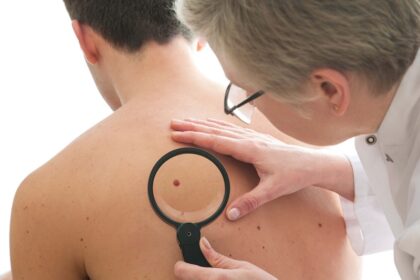 The Impact of Skin Cancer Clinics on Your Health