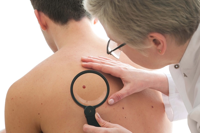 The Impact of Skin Cancer Clinics on Your Health